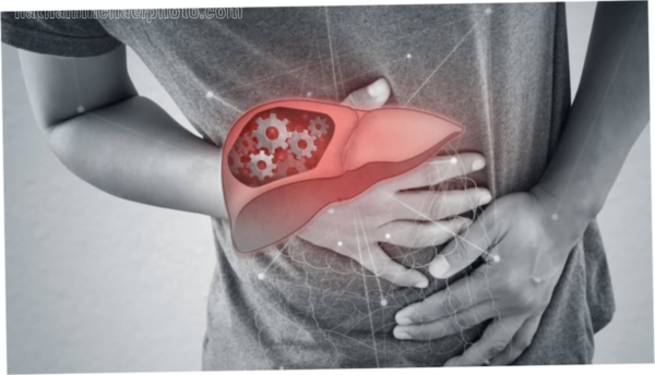 MASLD Explained: How Lifestyle Changes Can Reverse Fatty Liver Disease Naturally