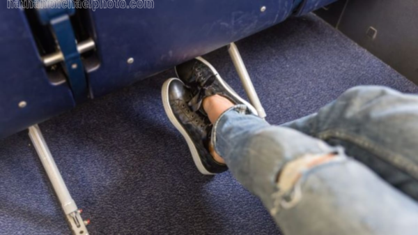 How to Prevent Leg and Ankle Swelling After Long Flights: Expert Winter Travel Tips